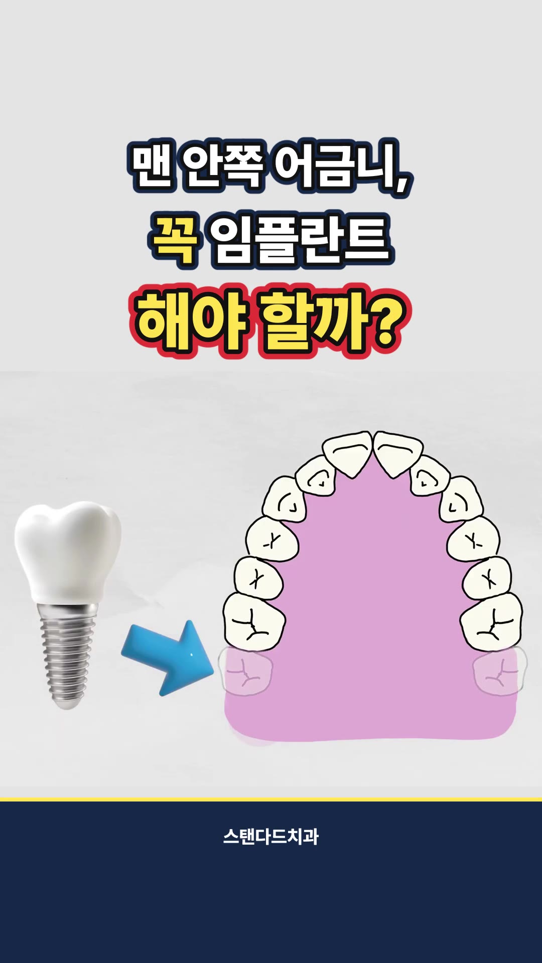 스탠다드치과 쇼츠 첫 화면